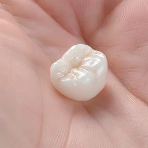 Porcelain crowns and bridges