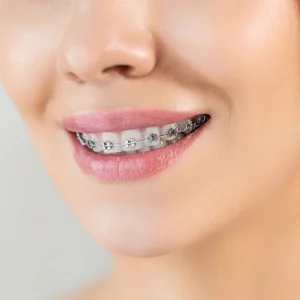 Orthodontics