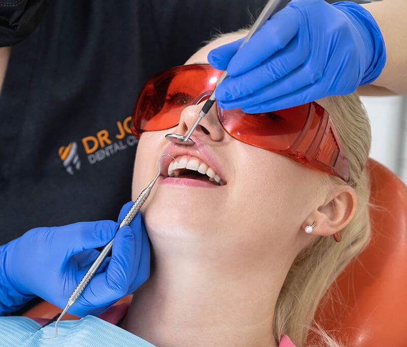 Laser-Gum-Depigmentation-o