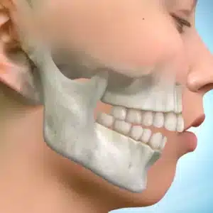Conceptual virtual simulation and wax modeling