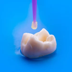 Composite Bonding
