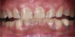 Before Treatment Photo