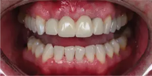 Before Treatment Photo
