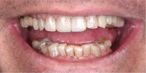 Before Treatment Photo