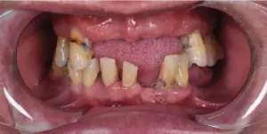 Before Treatment Photo