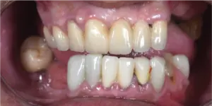 Before Treatment Photo