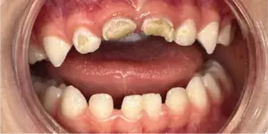 Before Treatment Photo