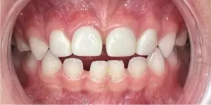 After Treatment Photo