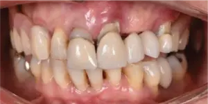 Before Treatment Photo