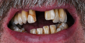Before Treatment Photo