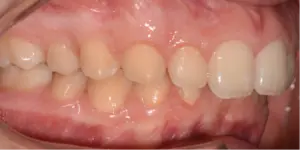 Before Treatment Photo