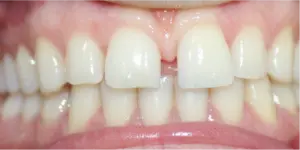 Before Treatment Photo