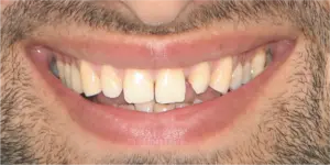Before Treatment Photo
