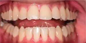Before Treatment Photo