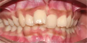 Before Treatment Photo
