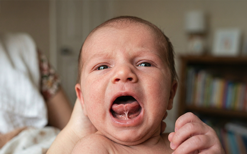 img-tongue-tie-child