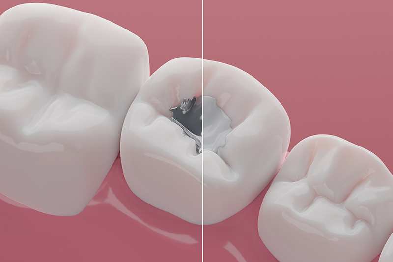 img-smart-removal