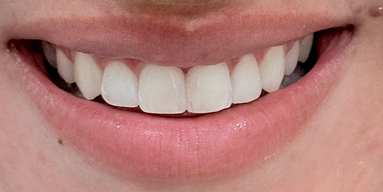 After